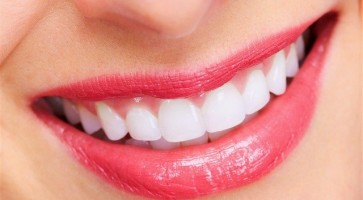 Bọc răng sứ nguyên hàm có được không?